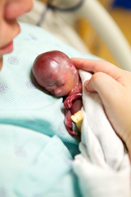 La historia de un feto de 19 semanas se hace viral seis años después de su muerte