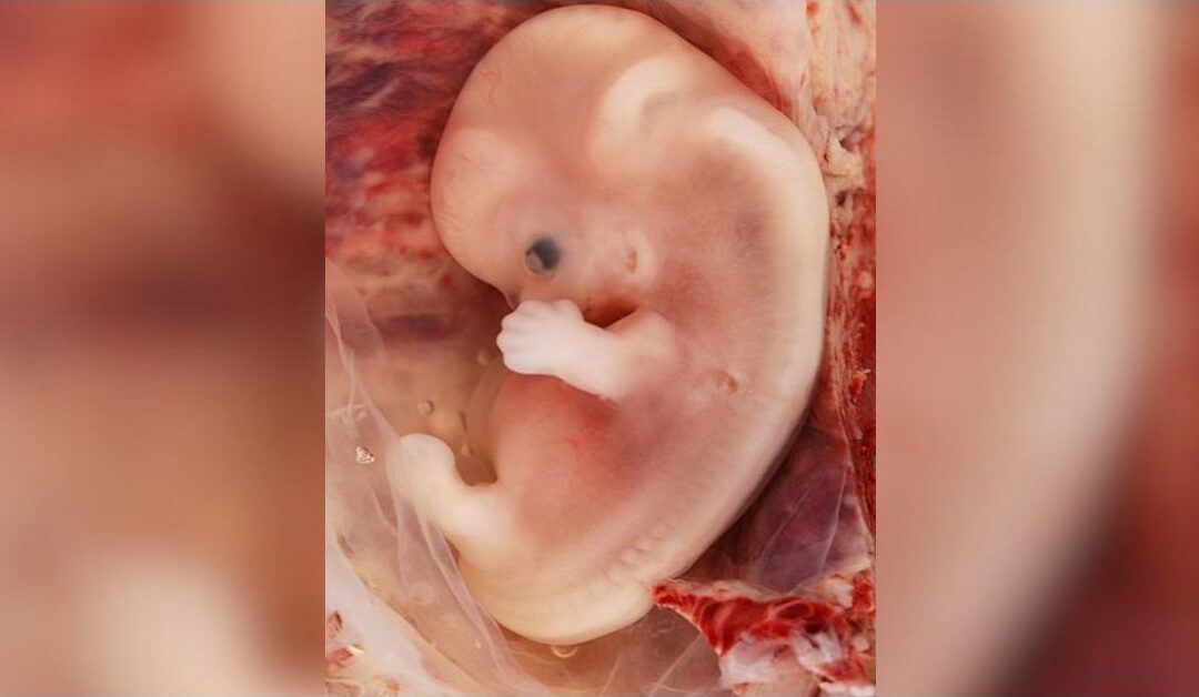 Reflexión sobre la defensa de la vidaSin Autor