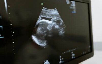 ¿A quién daña la Fecundación in Vitro?Sin Autor